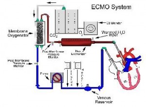 ecmo machine web