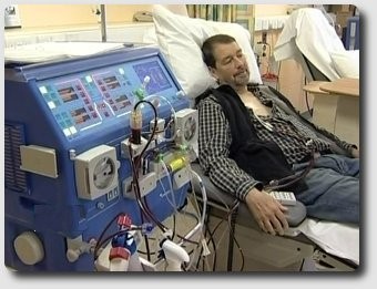 dialysis at Wythenshawe